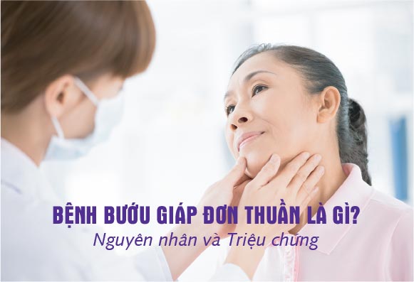 Bướu giáp đơn thuần là bệnh lý gây ra do sự tăng kích thước của tuyến giáp