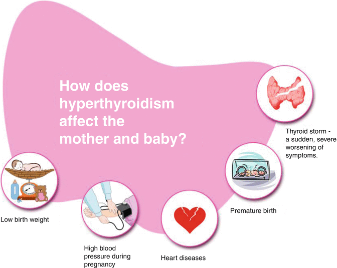 Thyroid Dysfunction and Its Emergencies in Pregnancy | Obgyn Key