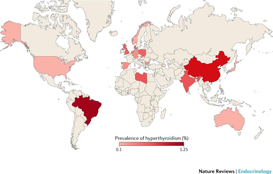 Global epidemiology of hyperthyroidism and hypothyroidism | Nature Reviews  Endocrinology