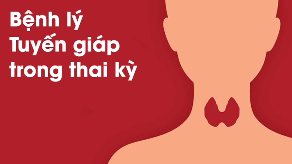 Bệnh lý tuyến giáp trong thai kỳ có thể ảnh hưởng đến kết cục của mẹ và bé