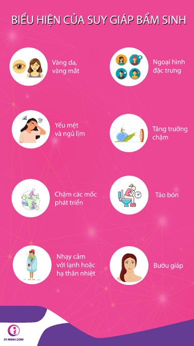 Các biểu hiện thường thấy của suy giáp bẩm sinh