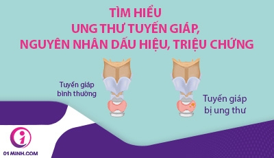 Tìm hiểu Ung thư tuyến giáp, nguyên nhân, dấu hiệu, triệu chứng