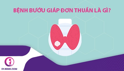 Bệnh bướu giáp đơn thuần